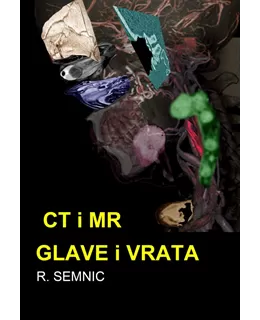 ct_i_mr_glave_i_vrata