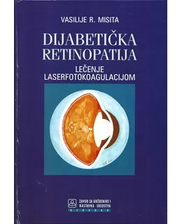 dijabetika_retinopatija_-_leenje_laserfotokoagulacijom