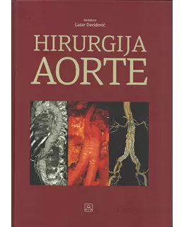 hirurgija_aorte