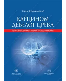 karcinom_debelog_creva_od_prevencije_preko_karcinogeneze_do_metastaze