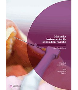 mainska_instrumentacija_kanala_korena_zuba