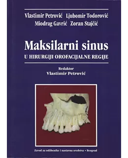 maksilarni_sinus_u_hirurgiji_orofacijalne_regije