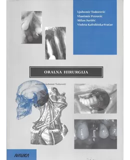 oralna_hirurgija