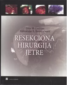 resekciona_hirurgija_jetre__cd