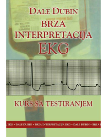 ekg