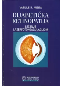 dijabetika_retinopatija_-_leenje_laserfotokoagulacijom