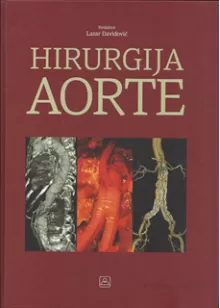 hirurgija_aorte